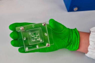 Stopping severe malaria by harnessing natural human antibodies