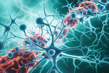 Network-based analyses uncover how neuroinflammation-causing microglia in Alzheimer’s disease form