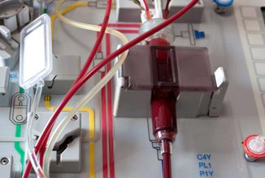 New drug tested to reduce side effect of ‘half-matched’ stem cell transplants