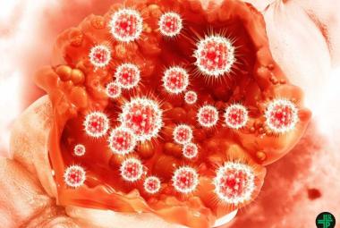 Combination of dual-targeted therapies and chemotherapy shows high response rates in BRAF-mutated metastatic colorectal cancer