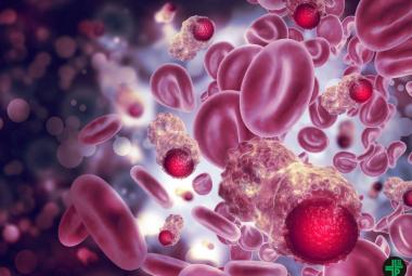 HKUMed confirms clozapine safety with first big-data evidence on rare blood cancer cases