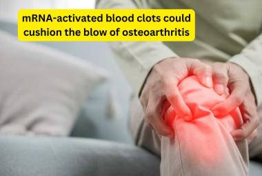 mRNA-activated blood clots could cushion the blow of osteoarthritis