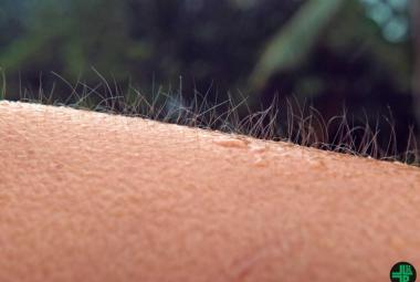 Zika uses human skin as mosquito magnet to spread virus further