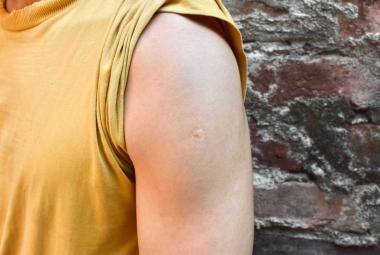 Groundbreaking study shows potential of new mRNA vaccine to help fight tuberculosis