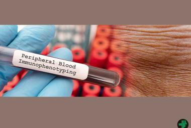 UM School of Medicine Dermatology Researchers Discover New Skin Disease Using Innovative Diagnostic Platform