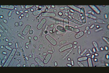 Newly identified bacterial protein to help with design of cancer drug delivery system
