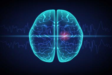 Common genetic variants linked to drug-resistant epilepsy