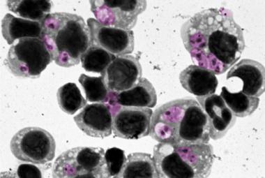 Researchers Discover Way to Predict Treatment Success for Parasitic Skin Disease