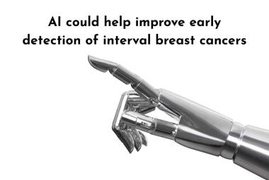 AI could help improve early detection of interval breast cancers