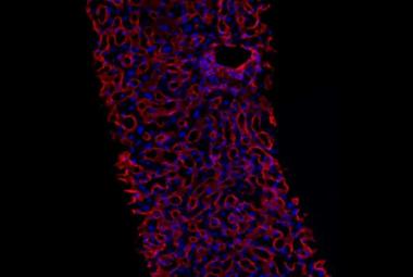 Drug reshapes tissue architecture to reduce damage in alcohol-related liver disease