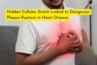 Hidden Cellular Switch Linked to Dangerous Plaque Rupture in Heart Disease