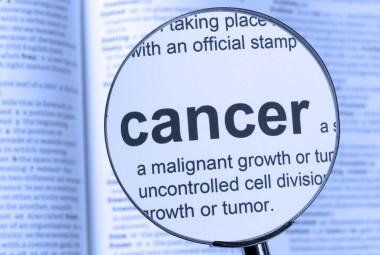 Newly discovered virus linked to colorectal cancer