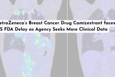 AstraZeneca’s Breast Cancer Drug Camizestrant faces US FDA Delay as Agency Seeks More Clinical Data