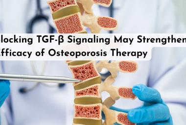 Blocking TGF-β Signaling May Strengthen Efficacy of Osteoporosis Therapy