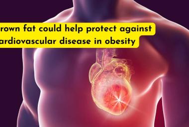 Brown fat could help protect against cardiovascular disease in obesity