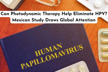 Can Photodynamic Therapy Help Eliminate HPV? Mexican Study Draws Global Attention