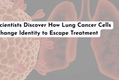 Scientists Discover How Lung Cancer Cells Change Identity to Escape Treatment