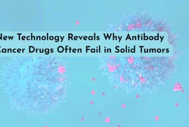 New Technology Reveals Why Antibody Cancer Drugs Often Fail in Solid Tumors