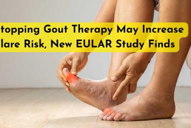 Stopping Gout Therapy May Increase Flare Risk, New EULAR Study Finds