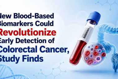 New Blood-Based Biomarkers Could Revolutionize Early Detection of Colorectal Cancer, Study Finds