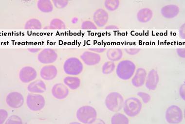 Scientists Uncover Antibody Targets That Could Lead to First Treatment for Deadly JC Polyomavirus Brain Infection