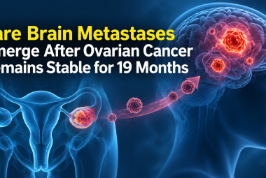 Rare Brain Metastases Emerge After Ovarian Cancer Remains Stable for 19 Months