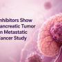 VEGFR Inhibitors Show Strong Pancreatic Tumor Control in Metastatic Kidney Cancer Study