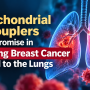 Mitochondrial Uncouplers Show Promise in Blocking Breast Cancer Spread to the Lungs