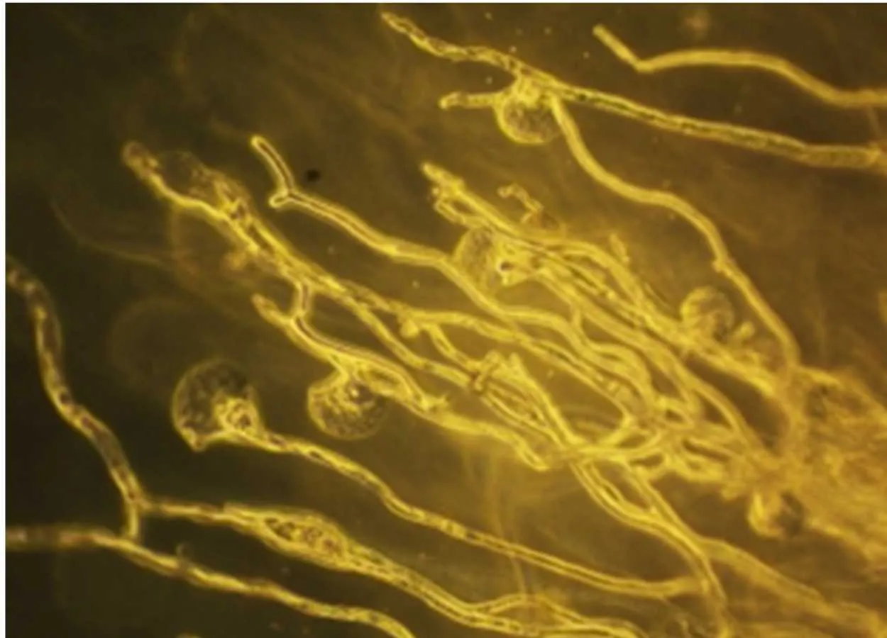 Drug delivery method can improve fungal infection treatment