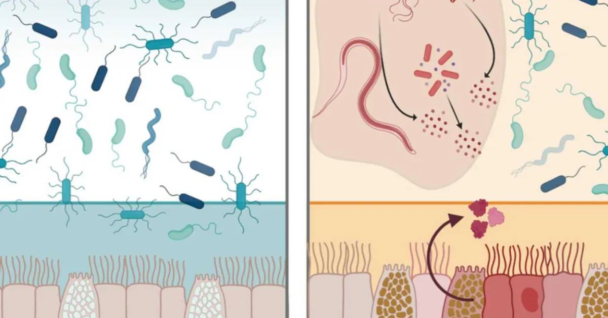 New Gut Protein Intelectin-2 Shows Promise as Natural Antimicrobial Defender