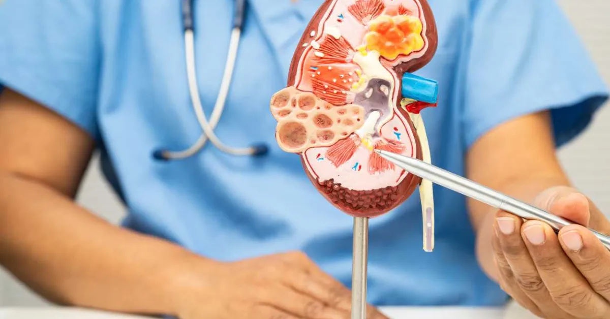 The Forgotten Half of Diabetic Kidney Disease Finally Gets Its Own Trial and the Results Are Positive