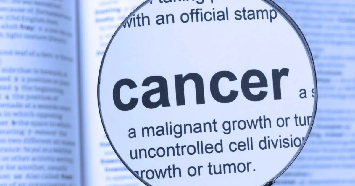 Newly discovered virus linked to colorectal cancer