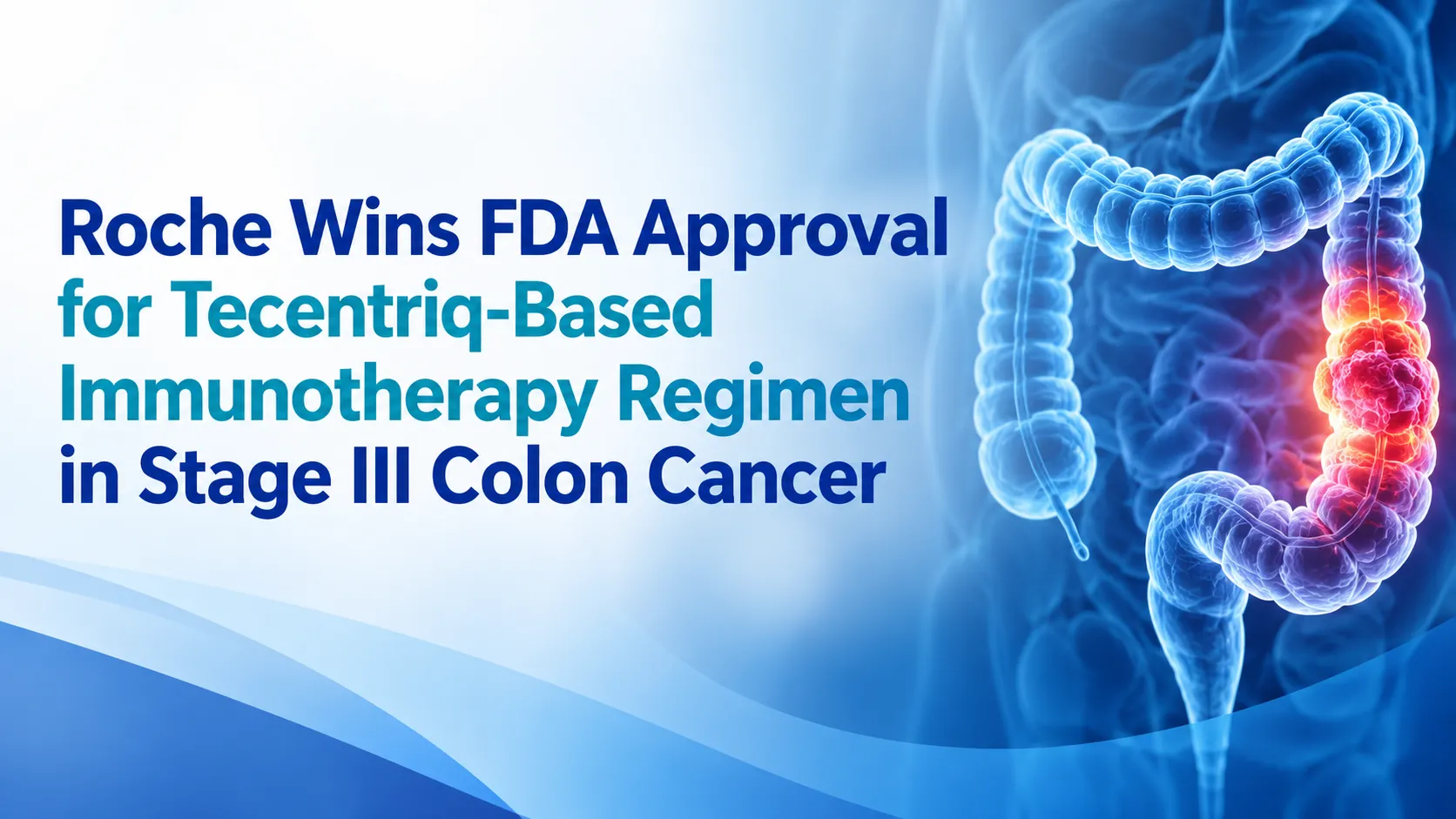Roche Wins FDA Approval for Tecentriq-Based Immunotherapy Regimen in Stage III Colon Cancer